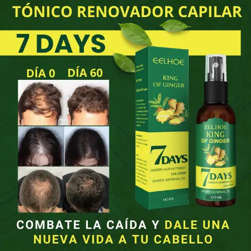 7 days cabello king of ginger